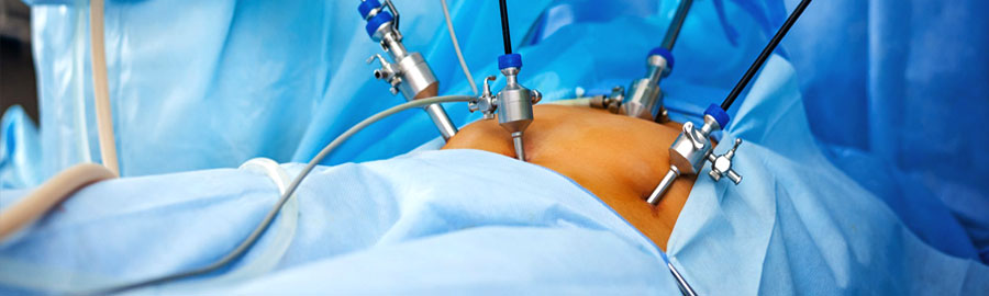 Advanced Laparoscopy & Endoscopy Advanced Laparoscopy & Endoscopy